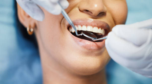 Best Broken or Cracked Tooth Emergency Dentist in Ferndale, WA