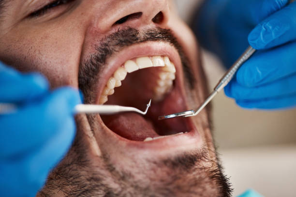 Best Orthodontic Emergency Dentist in Ferndale, WA