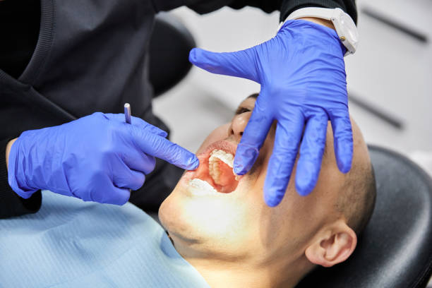 Best Emergency Root Canal Treatment in Ferndale, WA